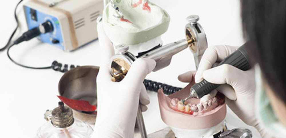 歯科技工士との提携